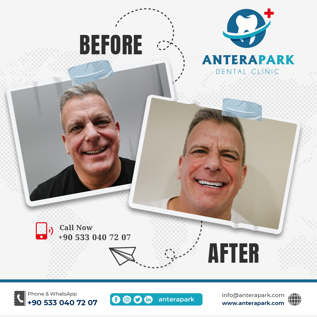 AnteraPark Dental