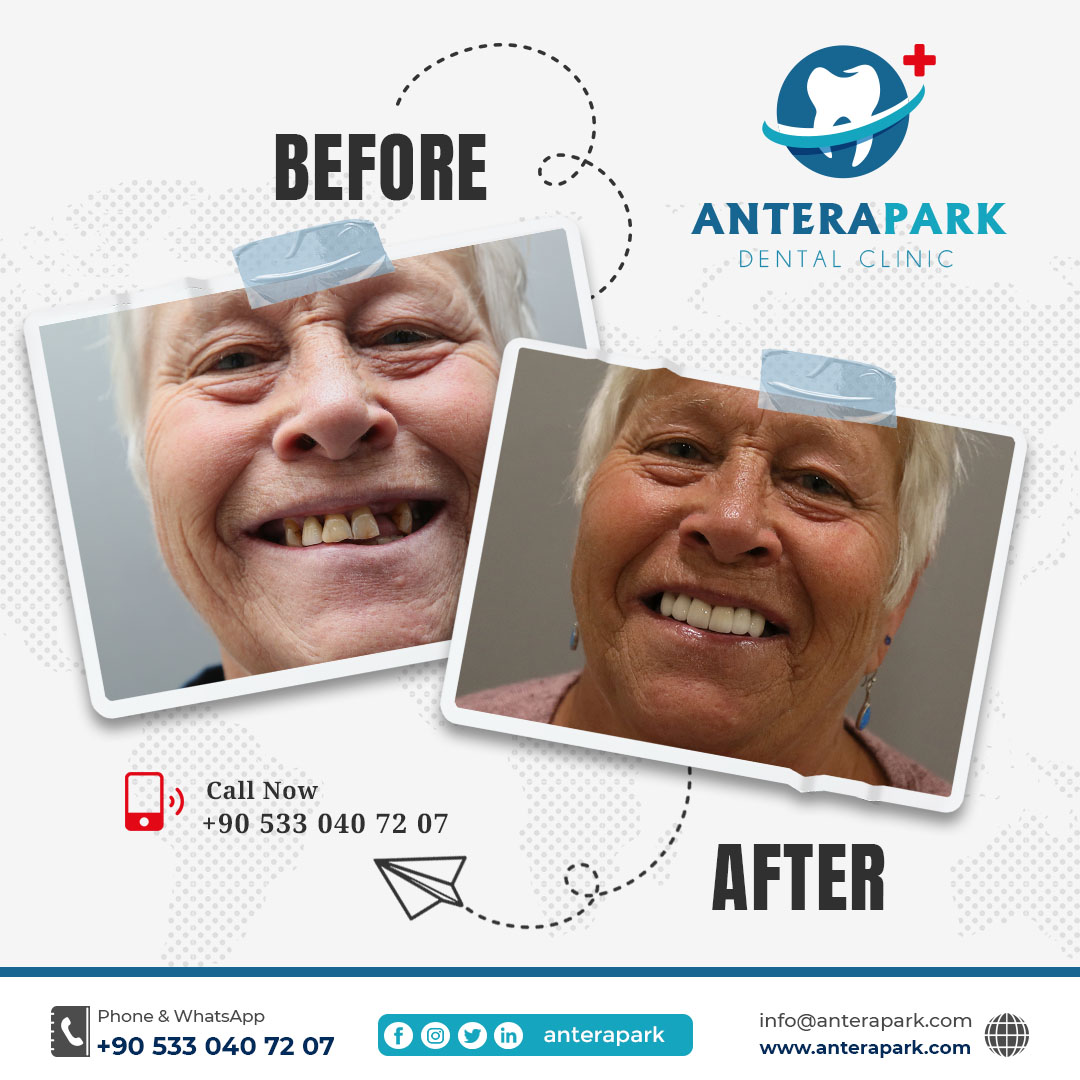 AnteraPark Dental